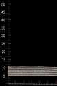 WT14284