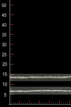 WT11040