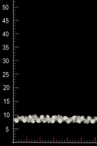 WT14970