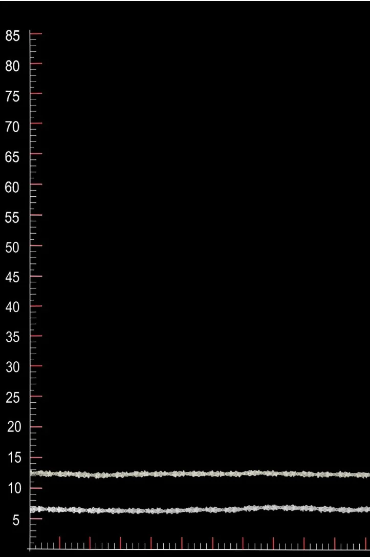 BAND 3D WT15271