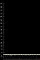 TRIM VL53075