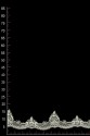 TRIM ML92125