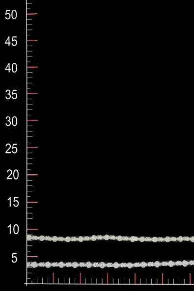 BAND ML711838